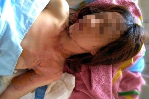 Hóa giải nghi án người phụ nữ bị phóng hỏa, cướp 500 triệu đồng