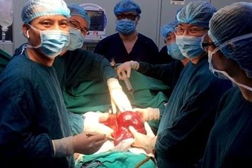 Cứu sản phụ có khối u gan 3kg thể hiếm gặp trên thế giới