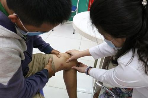 Mùa mưa, nhiều người viêm da do kiến ba khoang đốt