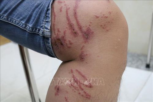 Cảnh báo mối nguy hiểm từ kiến ba khoang trong mùa mưa
