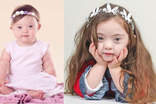 Nét đẹp như thiên thần của mẫu nhí 4 tuổi mắc hội chứng Down