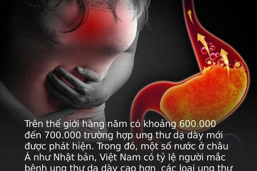 3 dấu hiệu bất thường ở bàn tay cho thấy dạ dày đang 'kêu cứu', ở độ tuổi nào cũng cần làm ngay 4 việc để ngăn cản ung thư hình thành