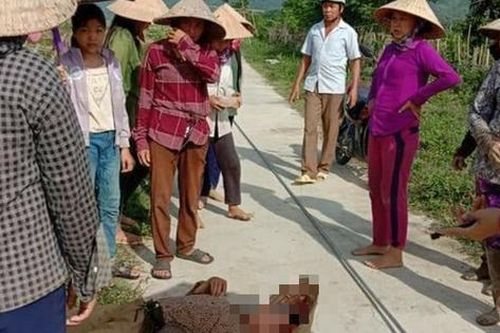 Nghệ An: Người phụ nữ bất tỉnh do dây điện rơi trúng đầu