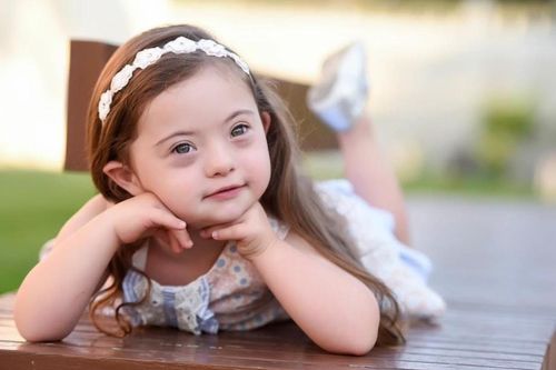 Cô bé mắc hội chứng Down trở thành mẫu nhí