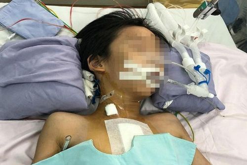 Nghi án bé trai thủng tim do bị đâm: Bệnh nhi đã tỉnh