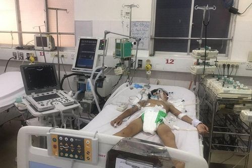 Bệnh nhi 4 tuổi tử vong vì bạch hầu, Gia Lai chỉ đạo dập dịch khẩn
