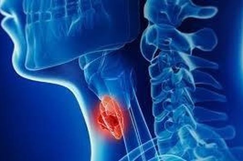 Chỉ một vài bước nhỏ, phát hiện ra ngay 'án tử' ung thư vòm họng