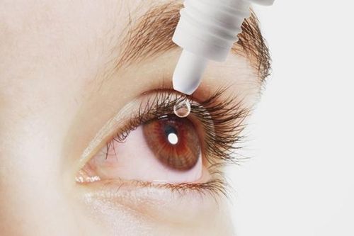 Viêm giác mạc sợi vì sao lâu khỏi?