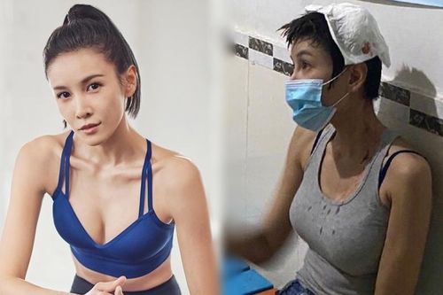 Diễn viên Trung Quốc bị thương nặng ở đầu trên phim trường