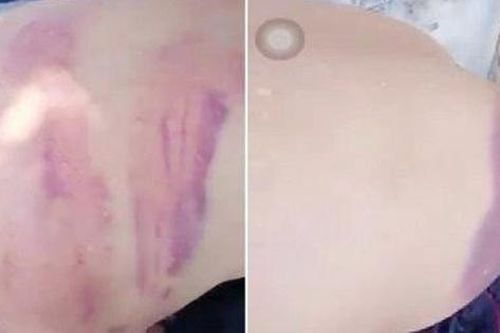 Sự thực câu chuyện người đàn ông mù là 'đại gia' ăn xin bị vợ hờ nhiều tuổi đánh bầm dập