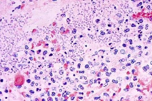 Cảnh giác với bệnh dịch hạch xuất hiện tại Trung Quốc