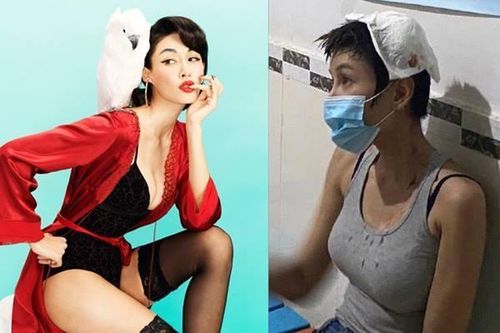 Đả nữ phim Thành Long bị thương nặng ở đầu khi quay phim