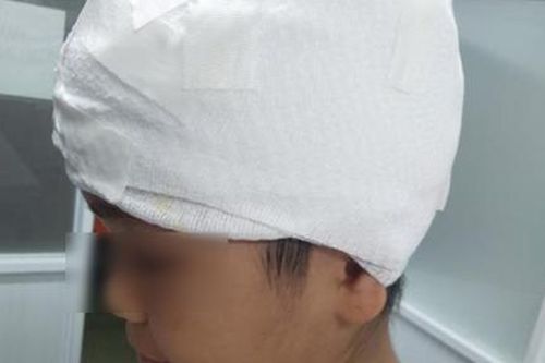 Máy cưa nước đá lột hơn một nửa da đầu của bé gái 11 tuổi
