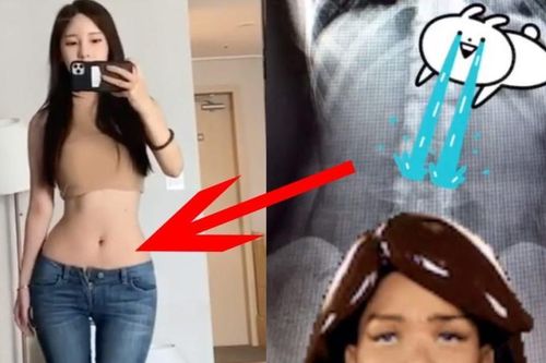 Thực hư tin đồn tác giả webtoon đình đám True Beauty' bị tố phẫu thuật thẩm mỹ để có thân hình đồng hồ cát