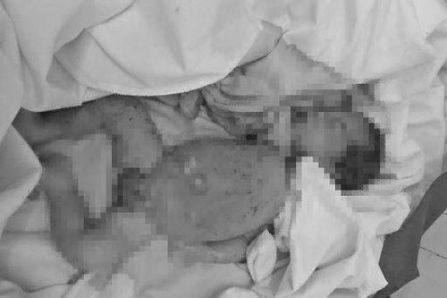 Tiền Giang: Bắt giữ cô gái 19 mang balo chứa thi thể bé sơ sinh