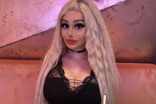Chồng mạnh tay chi gần 4 tỷ đồng để vợ thẩm mỹ để giống búp bê Barbie