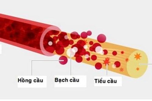 Cần làm gì khi bị xuất huyết giảm tiểu cầu?