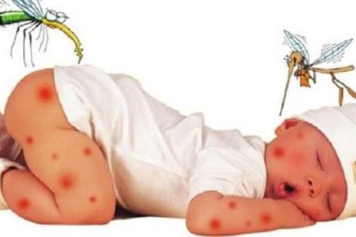 Cẩn trọng trong 'mùa' của viêm não