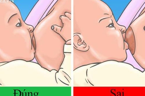 Chuyên gia tư vấn 5 việc mẹ bầu nên biết trước khi chuyển dạ