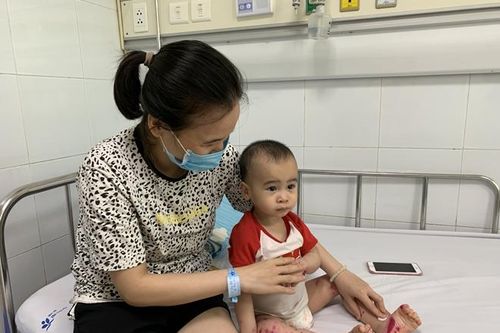Trẻ mắc tay chân miệng tăng gấp 5-6 lần