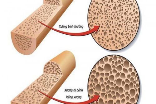 Cách dùng xương ngựa làm thuốc