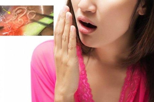 Hãi hùng cảnh bác sĩ gắp ra con giun dài 38mm từ miệng một người phụ nữ