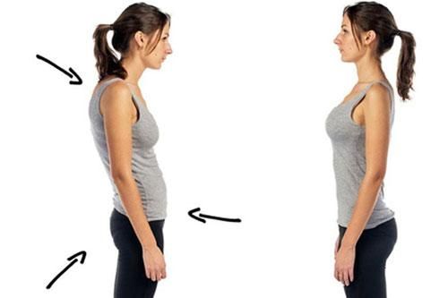 Gù lưng: Nguyên nhân và biện pháp giúp dân văn phòng tránh khắc phục bệnh