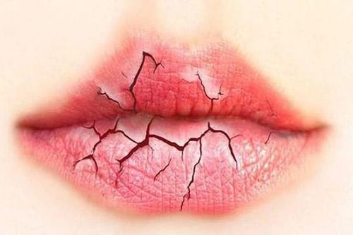 Khô miệng, vì sao?