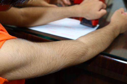 Bé gái Việt Nam đầu tiên mắc bệnh hiếm, thế giới chỉ có 74 ca