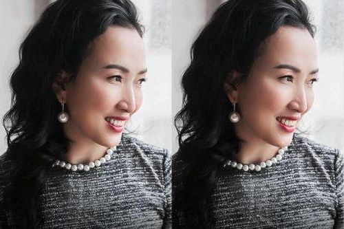 Cơ chế ngừa chảy xệ của kỹ thuật Filler MD Dynamic Codes