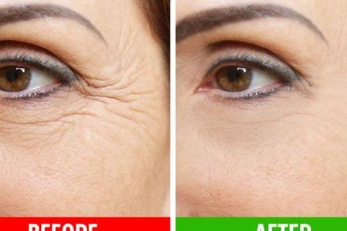 5 loại tinh dầu giúp chống lại nếp nhăn hiệu quả nhất, bạn đã biết chưa?