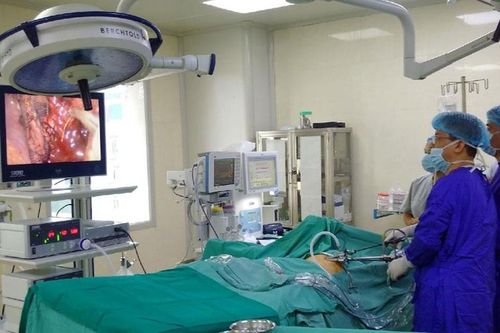 Bé trai 5 tuổi ở Hà Nội bị viêm ruột thừa do nuốt phải xương cá