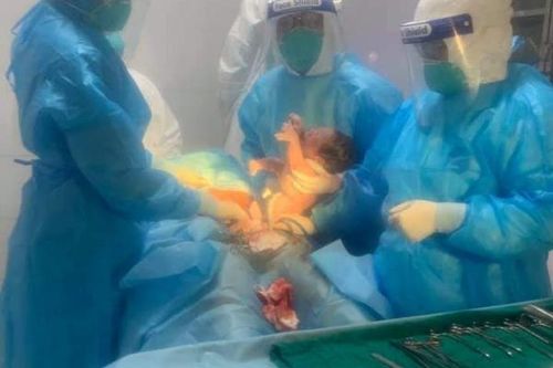 Lập phòng mổ dã chiến cứu bà bầu từ Australia về nước, đón bé trai 3,5kg
