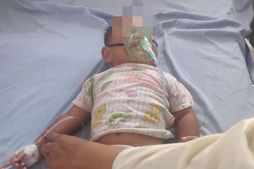 Bé 16 tháng tuổi uống nhầm dầu hỏa trong chai nước giải khát
