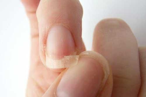 Dấu hiệu ở móng tay cho biết bạn đang gặp rắc rối về sức khỏe