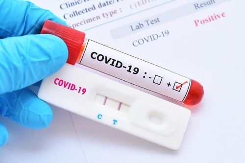 Singapore phát triển bộ xét nghiệm Covid-19 trong 2 giờ