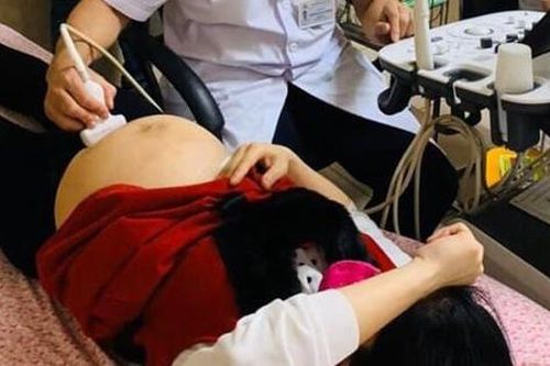Thai phụ nếu không quên điều này hoàn toàn có thể phát hiện dị tật dính liền như cặp song Nhi ngay từ 8 – 9 tuần thai