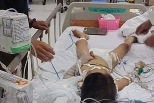 Công an Bình Phước làm rõ vụ bé trai nguy kịch sau khi mổ lấy đinh ở tay