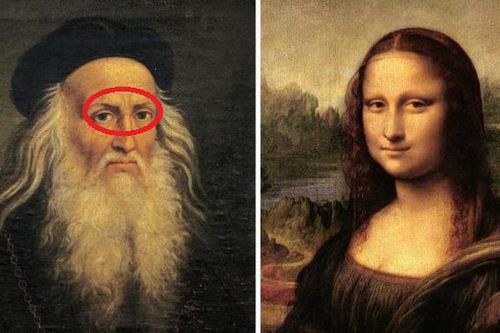 Giả thiết về căn bệnh lạ giúp danh họa Leonardo da Vinci tạo ra các tuyệt tác hội họa vĩ đại