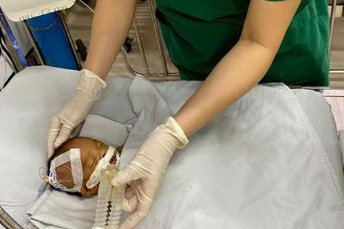 Nhói lòng bé trai dị tật bị bỏ rơi trước cổng chùa