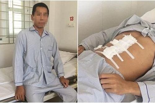 Bực mình do cãi vã, thanh niên tự dùng dao đâm vào bụng