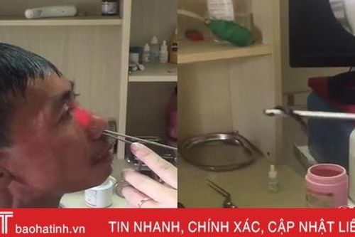 Xem bác sỹ ở Hà Tĩnh gắp con đỉa trong hốc mũi người đàn ông đến từ Quảng Bình