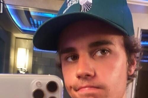 Justin Bieber hết sạch mụn nhờ vợ