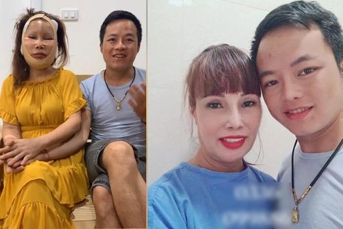 Gương mặt méo xệch hậu 'dao kéo' của cô dâu 62 tuổi được cải thiện?