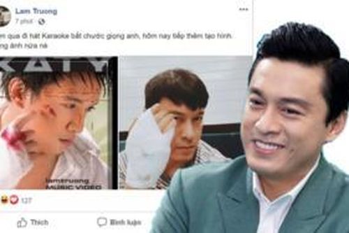 Băng bó kín tay vì trật khớp, Lam Trường tranh thủ tái hiện lại ảnh bìa CD đình đám gần chục năm trước khiến fan 'cạn lời'