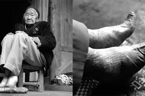 Ký ức bó chân kinh hoàng qua lời kể của cụ bà trăm tuổi có đôi chân 8cm