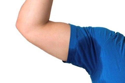 Nách nhiều mồ hôi, phải làm gì?