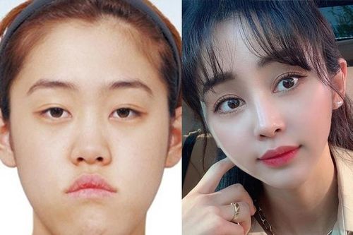 Cô gái Hàn Quốc đổi đời thế nào sau 8 năm phẫu thuật thẩm mỹ?
