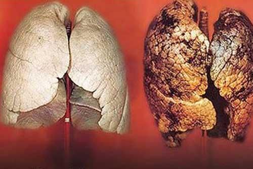 Đây chính là loại quả ăn vào lọc sạch phổi cho người hút thuốc lá, ai cũng nên biết để tự cứu mình
