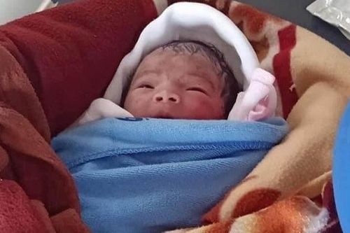 Bé gái sơ sinh bị bỏ rơi ngoài thửa ruộng trong cái nóng gần 40 độ C, bong da do cháy nắng